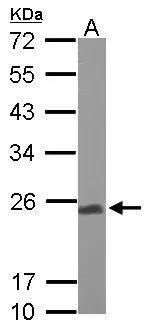 Sample (50 ug of whole cell lysate) A: Mouse brain 12% SDS PAGE GTX102150 diluted at 1:1000