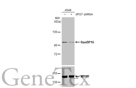 Non-transfected (–) and transfected (+) A549 whole cell extracts (30 μg) were separated by 5% SDS-PAGE, and the membrane was blotted with RanBP16 antibody [C2C3], C-term (GTX102166) diluted at 1:9000. The HRP-conjugated anti-rabbit IgG antibody (GTX213110-01) was used to detect the primary antibody.