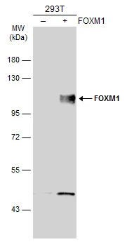 Non-transfected (–) and transfected (+) 293T whole cell extracts (30 μg) were separated by 7.5% SDS-PAGE, and the membrane was blotted with FOXM1 antibody (GTX102170) diluted at 1:5000. The HRP-conjugated anti-rabbit IgG antibody (GTX213110-01) was used to detect the primary antibody.