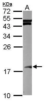Sample (50 ug of whole cell lysate) A: mouse brain 15% SDS PAGE GTX102190 diluted at 1:1000 Sample (50 ug of whole cell lysate) A: mouse brain 15% SDS PAGE GTX102190 diluted at 1:1000