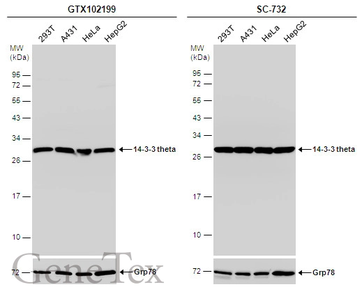 Various whole cell extracts (30 μg) were separated by 12% SDS-PAGE, and the membranes were blotted with 14-3-3 theta antibody (GTX102199) diluted at 1:1000 and competitor's antibody (SC-732) diluted by 1:1000. The HRP-conjugated anti-rabbit IgG antibody (GTX213110-01) was used to detect the primary antibody.