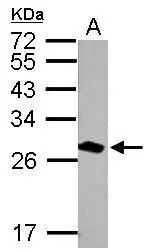 Sample (20 μg of whole cell lysate) A: mouse brain 12% SDS PAGE GTX102199 diluted at 1:30000 The HRP-conjugated anti-rabbit IgG antibody (GTX213110-01) was used to detect the primary antibody.
