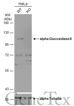 Wild-type (WT) and alpha Glucosidase II knockout (KO) HeLa cell extracts (30 μg) were separated by 7.5% SDS-PAGE, and the membrane was blotted with alpha Glucosidase II antibody [C2C3], C-term (GTX102205) diluted at 1:500. The HRP-conjugated anti-rabbit IgG antibody (GTX213110-01) was used to detect the primary antibody.