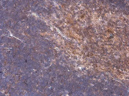 ARHGEF18 antibody detects ARHGEF18 protein at cytoplasm by immunohistochemical analysis. Sample: Paraffin-embedded mouse thymus gland. ARHGEF18 stained by ARHGEF18 antibody (GTX102223) diluted at 1:500.
 Antigen Retrieval: Citrate buffer, pH 6.0, 15 min
