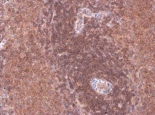 ARHGEF18 antibody detects ARHGEF18 protein at cell membrane and cytoplasm by immunohistochemical analysis. Sample: Paraffin-embedded rat spleen. ARHGEF18 stained by ARHGEF18 antibody (GTX102223) diluted at 1:500.
 Antigen Retrieval: Citrate buffer, pH 6.0, 15 min