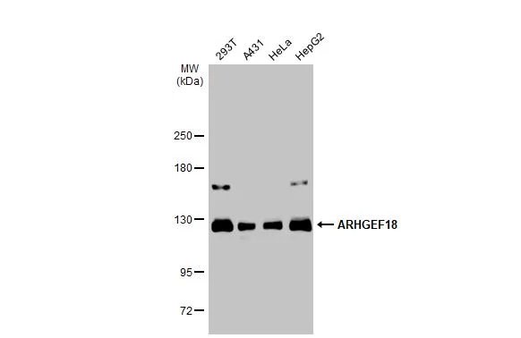 Various whole cell extracts (30 μg) were separated by 5% SDS-PAGE, and the membrane was blotted with ARHGEF18 antibody (GTX102223) diluted at 1:1000. The HRP-conjugated anti-rabbit IgG antibody (GTX213110-01) was used to detect the primary antibody.