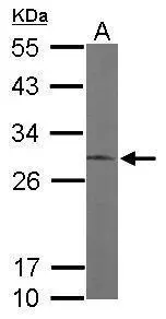 Sample (50 μg of whole cell lysate) A: Mouse brain 12% SDS PAGE GTX102225 diluted at 1:1000 The HRP-conjugated anti-rabbit IgG antibody (GTX213110-01) was used to detect the primary antibody.