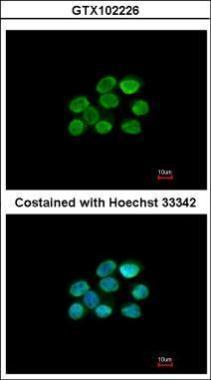 Sample (30 ug of whole cell lysate) A:NIH-3T3 7.5% SDS PAGE GTX102226 diluted at 1:1000 The HRP-conjugated anti-rabbit IgG antibody (GTX213110-01) was used to detect the primary antibody.