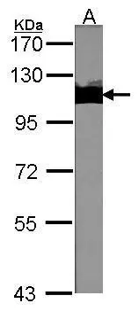 Sample (30 ug of whole cell lysate) A:NIH-3T3 7.5% SDS PAGE GTX102226 diluted at 1:1000 The HRP-conjugated anti-rabbit IgG antibody (GTX213110-01) was used to detect the primary antibody.
