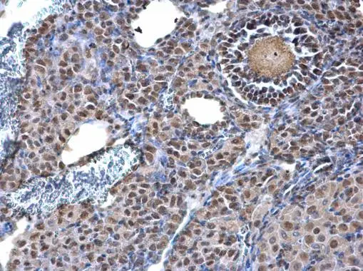 KAP1 antibody [N1N2], N-term detects KAP1 protein at nucleus on mouse ovary by immunohistochemical analysis. Sample: Paraffin-embedded mouse ovary. KAP1 antibody [N1N2], N-term (GTX102227) diluted at 1:500. 
 Antigen Retrieval: Trilogy? (EDTA based, pH 8.0) buffer, 15min