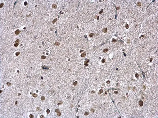 KAP1 antibody [N1N2], N-term detects KAP1 protein at nucleus on mouse ovary by immunohistochemical analysis. Sample: Paraffin-embedded mouse ovary. KAP1 antibody [N1N2], N-term (GTX102227) diluted at 1:500. 
 Antigen Retrieval: Trilogy? (EDTA based, pH 8.0) buffer, 15min