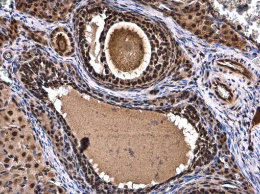 XBP1 antibody [N3C3] detects XBP1 protein at nucleus in rat ovary by immunohistochemical analysis. Sample: Paraffin-embedded rat ovary. XBP1 antibody [N3C3] (GTX102229) diluted at 1:500. 
 Antigen Retrieval: Citrate buffer, pH 6.0, 15 min