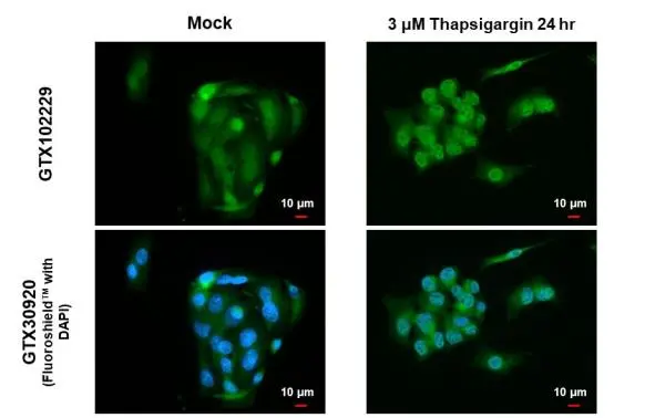 XBP1 antibody [N3C3] detects XBP1 protein at nucleus by immunofluorescent analysis. Sample: HepG2 cells were fixed in 4% paraformaldehyde at RT for 15 min. Green: XBP1 stained by XBP1 antibody [N3C3] (GTX102229) diluted at 1:500. Blue: Fluoroshield with DAPI (GTX30920).