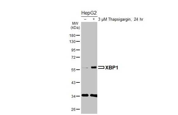 Untreated (–) and treated (+) HepG2 whole cell extracts (30 μg) were separated by 10% SDS-PAGE, and the membrane was blotted with XBP1 antibody [N3C3] (GTX102229) diluted at 1:1000. The HRP-conjugated anti-rabbit IgG antibody (GTX213110-01) was used to detect the primary antibody.