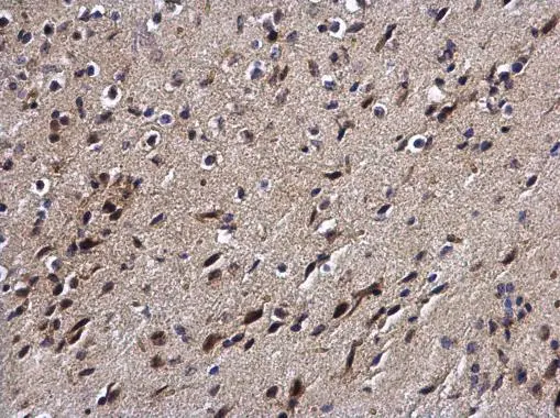 DPF2 antibody detects DPF2 protein at cytoplasm and nucleus on mouse brain by immunohistochemical analysis. Sample: Paraffin-embedded mouse brain. DPF2 antibody (GTX102235) diluted at 1:500. 
 Antigen Retrieval: Trilogy? (EDTA based, pH 8.0) buffer, 15min