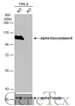 Wild-type (WT) and alpha Glucosidase II knockout (KO) HeLa cell extracts (30 μg) were separated by 7.5% SDS-PAGE, and the membrane was blotted with alpha Glucosidase II antibody [N1N2], N-term (GTX102237) diluted at 1:1000. The HRP-conjugated anti-rabbit IgG antibody (GTX213110-01) was used to detect the primary antibody.