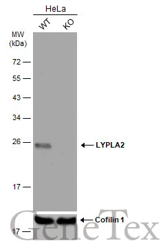 Wild-type (WT) and LYPLA2 knockout (KO) HeLa cell extracts (30 μg) were separated by 12% SDS-PAGE, and the membrane was blotted with LYPLA2 antibody [N1C3] (GTX102240) diluted at 1:1000. The HRP-conjugated anti-rabbit IgG antibody (GTX213110-01) was used to detect the primary antibody, and the signal was developed with Trident ECL plus-Enhanced.