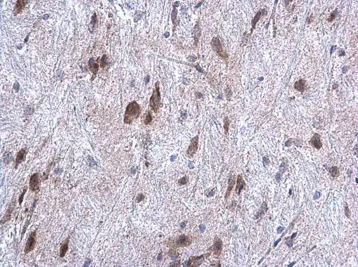 ORP150 antibody [C2C3], C-term detects ORP150 protein at cytoplasm on mouse fore brain by immunohistochemical analysis. Sample: Paraffin-embedded mouse fore brain. ORP150 antibody [C2C3], C-term (GTX102255) diluted at 1:500. 
 Antigen Retrieval: Trilogy? (EDTA based, pH 8.0) buffer, 15min