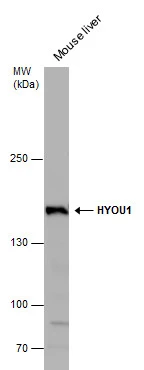 ORP150 antibody detects ORP150 protein by western blot analysis. Mouse tissue extracts (50 μg) was separated by 5% SDS-PAGE, and blotted with ORP150 antibody (GTX102255) diluted by 1:500. The HRP-conjugated anti-rabbit IgG antibody (GTX213110-01) was used to detect the primary antibody.