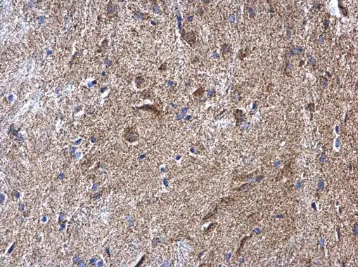 NDUFV2 antibody detects NDUFV2 protein at mitochondria on mouse heart by immunohistochemical analysis. Sample: Paraffin-embedded mouse heart. NDUFV2 antibody (GTX102259) diluted at 1:1000. 
 Antigen Retrieval: Trilogy? (EDTA based, pH 8.0) buffer, 15min