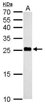 NDUFV2 antibody detects NDUFV2 protein by Western blot analysis. A. 50 μg mouse liver lysate/extract 12 % SDS-PAGE NDUFV2 antibody (GTX102259) dilution: 1:500