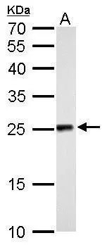NDUFV2 antibody detects NDUFV2 protein by Western blot analysis. A. 50 μg rat liver lysate/extract 12 % SDS-PAGE NDUFV2 antibody (GTX102259) dilution: 1:500