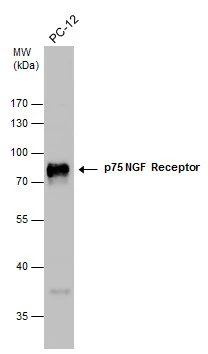 フォトEPC Alexa Fluor® 555 Anti-EpCAM antibody [EPR20532-222