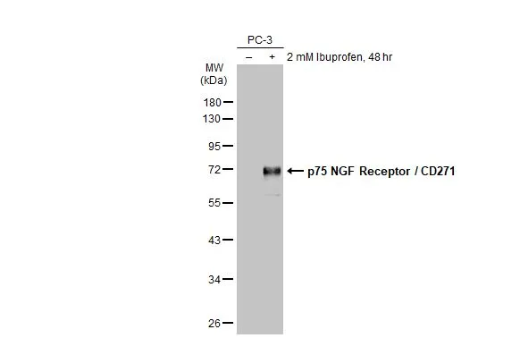 Untreated (–) and treated (+) PC-3 whole cell extracts (30 μg) were separated by 10% SDS-PAGE, and the membrane was blotted with p75 NGF Receptor / CD271 antibody (GTX102262) diluted at 1:1000. The HRP-conjugated anti-rabbit IgG antibody (GTX213110-01) was used to detect the primary antibody. Untreated (–) and treated (+) PC-3 whole cell extracts (30 μg) were separated by 10% SDS-PAGE, and the membrane was blotted with p75 NGF Receptor / CD271 antibody (GTX102262) diluted at 1:1000. The HRP-conjugated anti-rabbit IgG antibody (GTX213110-01) was used to detect the primary antibody.