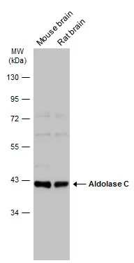 Various tissue extracts (50 μg) were separated by 10% SDS-PAGE, and the membrane was blotted with Aldolase C antibody [N1C1] (GTX102284) diluted at 1:1000. The HRP-conjugated anti-rabbit IgG antibody (GTX213110-01) was used to detect the primary antibody.