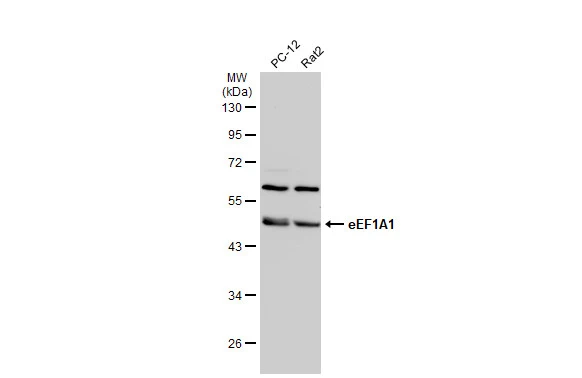 Various whole cell extracts (30 μg) were separated by 10% SDS-PAGE, and the membrane was blotted with eEF1A1 antibody [N1C1] (GTX102285) diluted at 1:500. The HRP-conjugated anti-rabbit IgG antibody (GTX213110-01) was used to detect the primary antibody.