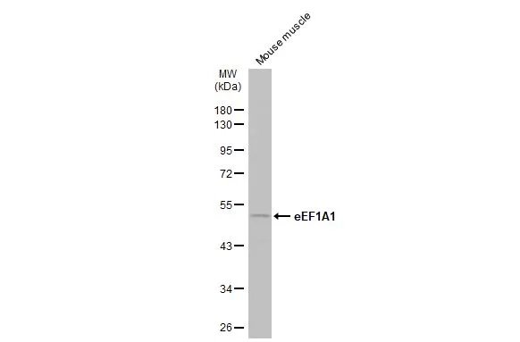 Mouse tissue extract (50 μg) was separated by 10% SDS-PAGE, and the membrane was blotted with eEF1A1 antibody [N1C1] (GTX102285) diluted at 1:500. The HRP-conjugated anti-rabbit IgG antibody (GTX213110-01) was used to detect the primary antibody.