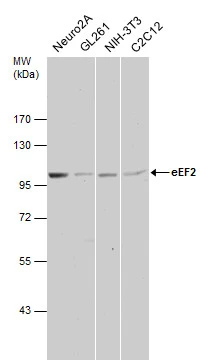 Various whole cell extracts (30 μg) were separated by 7.5% SDS-PAGE, and the membrane was blotted with eEF2 antibody [N2C1], Internal (GTX102287) diluted at 1:1000.