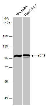 Various whole cell extracts (30 μg) were separated by 7.5% SDS-PAGE, and the membrane was blotted with eEF2 antibody [N2C1], Internal (GTX102287) diluted at 1:500.