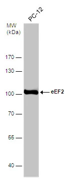Whole cell extract (30 μg) was separated by 7.5% SDS-PAGE, and the membrane was blotted with eEF2 antibody [N2C1], Internal (GTX102287) diluted at 1:500.