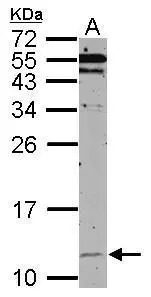 Sample (50 ug of whole cell lysate) A: mouse brain 15% SDS PAGE GTX102296 diluted at 1:500