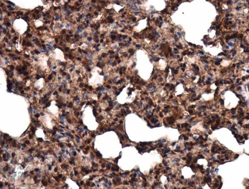 CLOCK antibody [C2C3], C-term detects CLOCK protein at cytoplasm and nucleus in rat lung by immunohistochemical analysis. Sample: Paraffin-embedded rat lung. CLOCK antibody [C2C3], C-term (GTX102318) diluted at 1:500. Antigen Retrieval: Citrate buffer, pH 6.0, 15 min