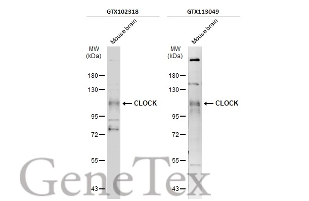 Mouse tissue extract (50 μg) was separated by 7.5% SDS-PAGE, and the membranes were blotted with CLOCK antibody [C2C3], C-term (GTX102318) diluted at 1:1000 and competitor's antibody diluted at 1:1000. The HRP-conjugated anti-rabbit IgG antibody (GTX213110-01) was used to detect the primary antibody, and the signal was developed with Trident ECL plus-Enhanced. *The competitor is not affiliated with GeneTex and does not endorse this product.
