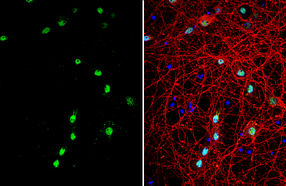CLOCK antibody [C2C3], C-term detects CLOCK protein by immunofluorescent analysis. Sample: DIV10 rat E18 primary cortical neuron cells were fixed in 4% paraformaldehyde at RT for 15 min. Green: CLOCK stained by CLOCK antibody [C2C3], C-term (GTX102318) diluted at 1:500. Red: Tau, stained by Tau antibody [GT287] (GTX634809) diluted at 1:500. Blue: Fluoroshield with DAPI (GTX30920).