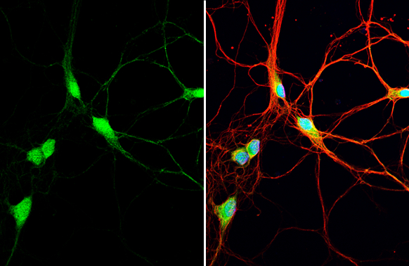AHA-1 antibody [N2C3] detects AHA-1 protein by immunofluorescent analysis. Sample: DIV9 rat E18 primary hippocampal neuron cells were fixed in 4% paraformaldehyde at RT for 15 min. Green: AHA-1 stained by AHA-1 antibody [N2C3] (GTX102321) diluted at 1:500. Red: beta Tubulin 3/ Tuj1, stained by beta Tubulin 3/ Tuj1 antibody [GT11710] (GTX631836) diluted at 1:500. Blue: Fluoroshield with DAPI (GTX30920).