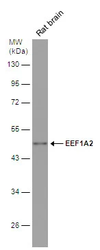 EEF1A2 antibody