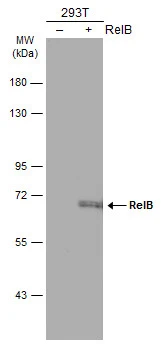 Non-transfected (–) and transfected (+) 293T whole cell extracts (30 μg) were separated by 7.5% SDS-PAGE, and the membrane was blotted with RelB antibody (GTX102332) diluted at 1:5000. The HRP-conjugated anti-rabbit IgG antibody (GTX213110-01) was used to detect the primary antibody.