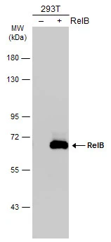 Non-transfected (–) and transfected (+) 293T whole cell extracts (30 μg) were separated by 7.5% SDS-PAGE, and the membrane was blotted with RelB antibody (GTX102333) diluted at 1:5000. The HRP-conjugated anti-rabbit IgG antibody (GTX213110-01) was used to detect the primary antibody.