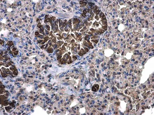 Calpain 1 antibody [N3C2], Internal detects Calpain 1 protein at cytoplasm on mouse lung by immunohistochemical analysis. Sample: Paraffin-embedded mouse lung. Calpain 1 antibody [N3C2], Internal (GTX102340) diluted at 1:500. 
 Antigen Retrieval: Trilogy? (EDTA based, pH 8.0) buffer, 15min