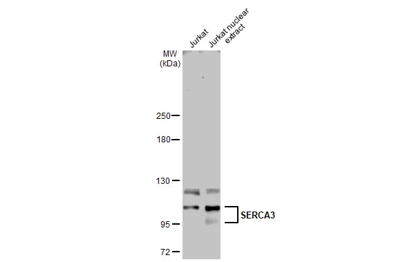 Jurkat whole cell and nuclear extracts (30 μg) were separated by 5% SDS-PAGE, and the membrane was blotted with SERCA3 antibody [N1N2], N-term (GTX102381) diluted at 1:500. The HRP-conjugated anti-rabbit IgG antibody (GTX213110-01) was used to detect the primary antibody.