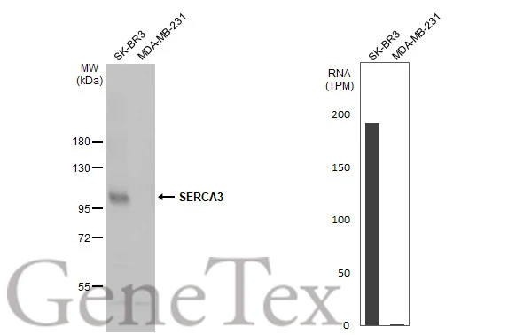 Various whole cell extracts (30 μg) were separated by 7.5% SDS-PAGE, and the membrane was blotted with SERCA3 antibody [N1N2], N-term (GTX102381) diluted at 1:500. The HRP-conjugated anti-rabbit IgG antibody (GTX213110-01) was used to detect the primary antibody. Corresponding RNA expression data for the same cell lines are based on Human Protein Atlas program.