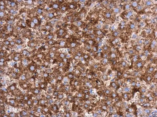 MEK1 antibody detects MEK1 protein at cytoplasm in rat liver by immunohistochemical analysis. Sample: Paraffin-embedded rat liver. MEK1 antibody (GTX102391) diluted at 1:500. 
 Antigen Retrieval: Citrate buffer, pH 6.0, 15 min