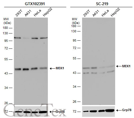 Various whole cell extracts (30 μg) were separated by 10% SDS-PAGE, and the membranes were blotted with MEK1 antibody (GTX102391) diluted at 1:1000 and competitor's antibody (SC-219) diluted by 1:200.