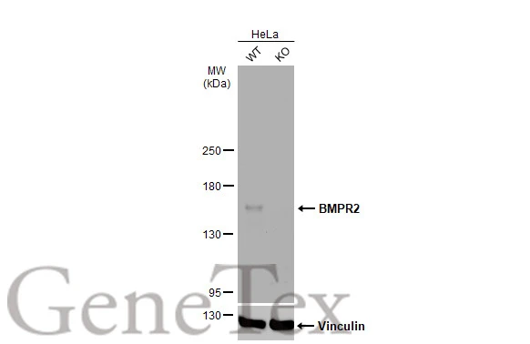Wild-type (WT) and BMPR2 knockout (KO) HeLa cell extracts (30 μg) were separated by 5% SDS-PAGE, and the membrane was blotted with BMPR2 antibody [C1C3] (GTX102418) diluted at 1:500. The HRP-conjugated anti-rabbit IgG antibody (GTX213110-01) was used to detect the primary antibody.