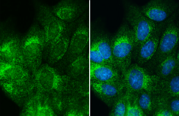 Albumin antibody detects Albumin protein at cytoplasm by immunofluorescent analysis. Sample: MDCK cells were fixed in 4% paraformaldehyde at RT for 15 min. Green: Albumin stained by Albumin antibody (GTX102419) diluted at 1:500. Blue: Hoechst 33342 staining.