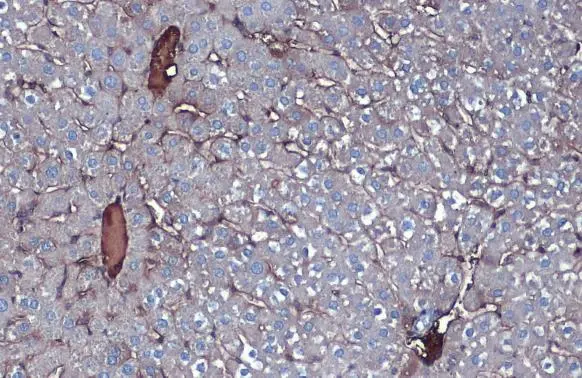 Anti-Albumin antibody (GTX102419) | GeneTex